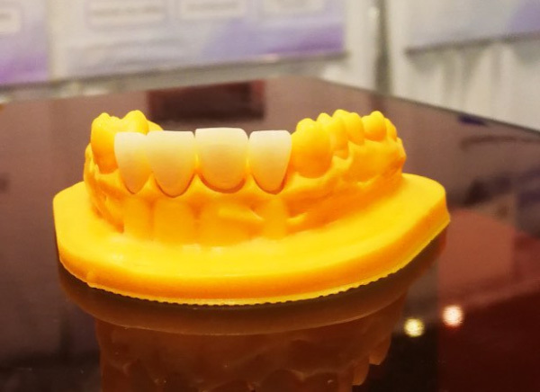 SLA 3D prints in dental industry